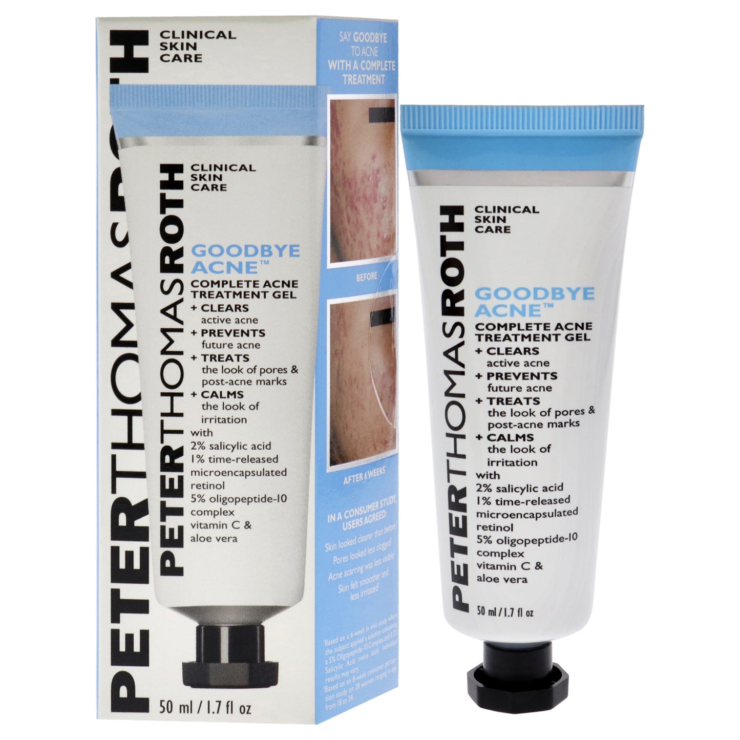 Good Bye Acne Complete Treatment Gel