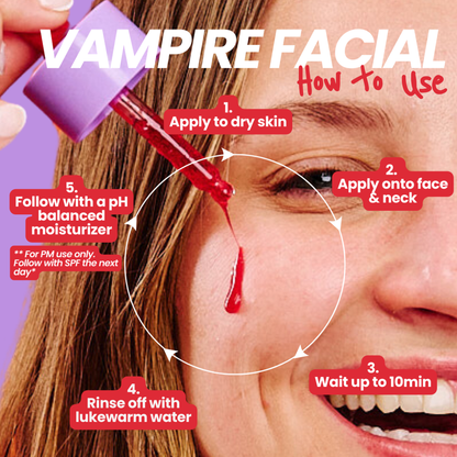 Vampire Facial