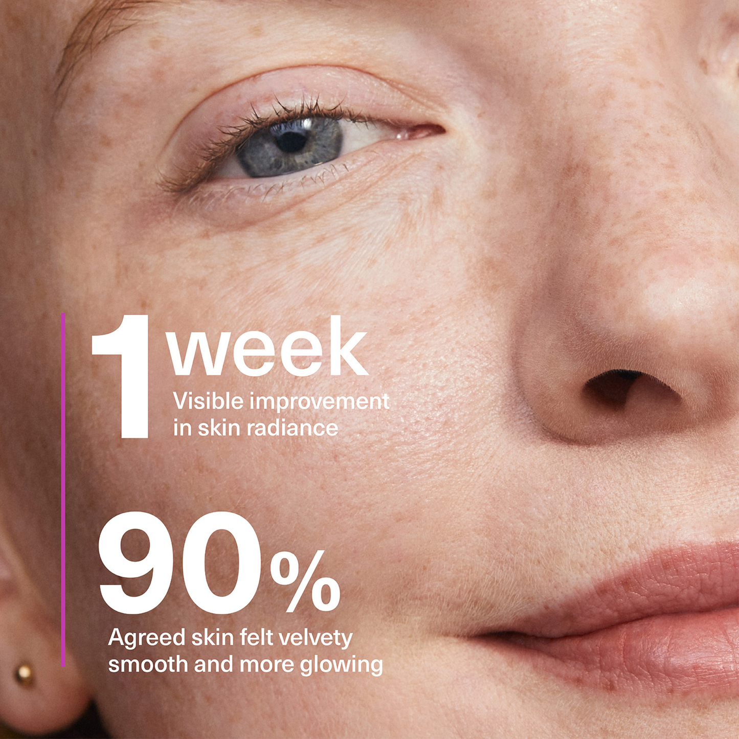 10% Niacinamide (Vitamin B3) Smoothing Serum
